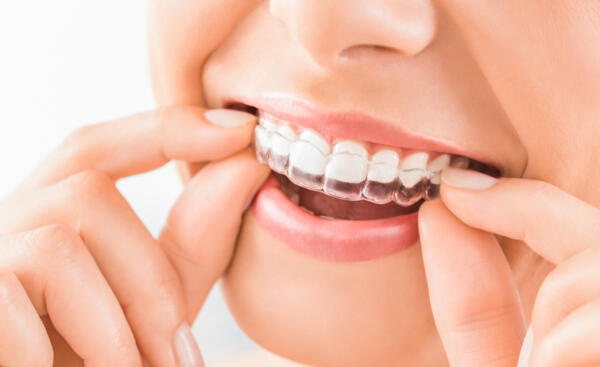 Les Aligneurs Orthodontiques Assistante