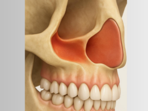 Le Sinus de fond en comble